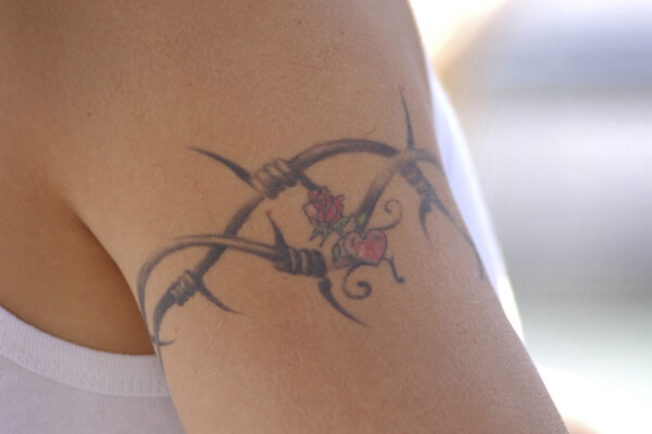 刺青（いれずみ）・タトゥーの除去